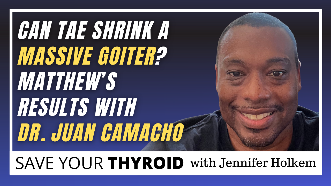 Can TAE Shrink a Massive Goiter? Matthew’s Results with Dr. Camacho